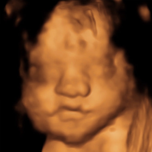 Real View Ultrasound Photo (Legacy)