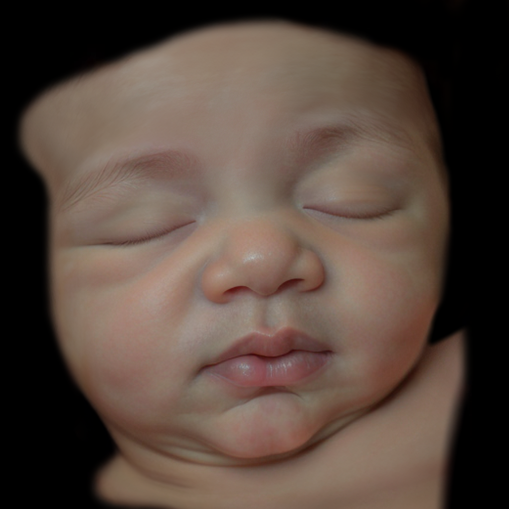 Real View Ultrasound Photo
