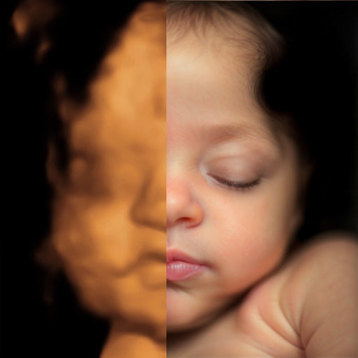 Real View Ultrasound Photo (Legacy)